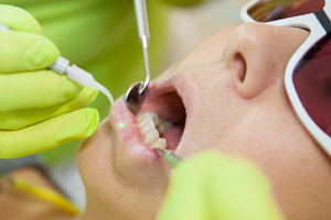 laserbehandlung-leistungen-zahnaerztin-isabella-vorreiter-in-hinterschmiding